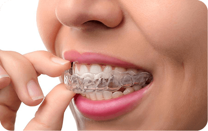 Invisalign aligners at Dental Solutions